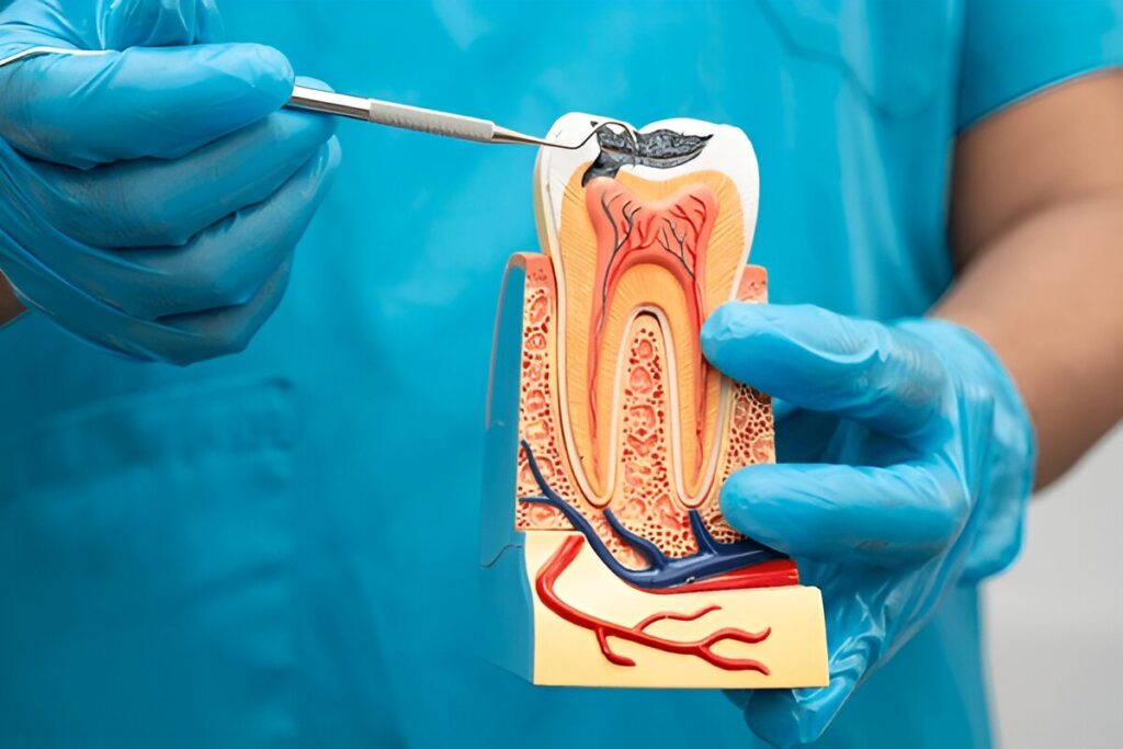 boca raton root canal