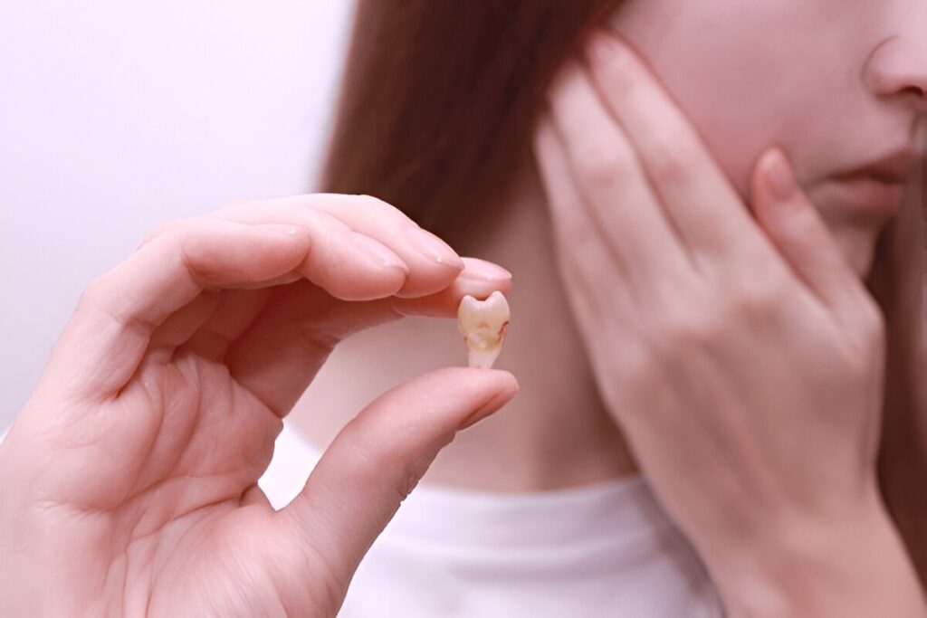 tooth extractions in Boca Raton