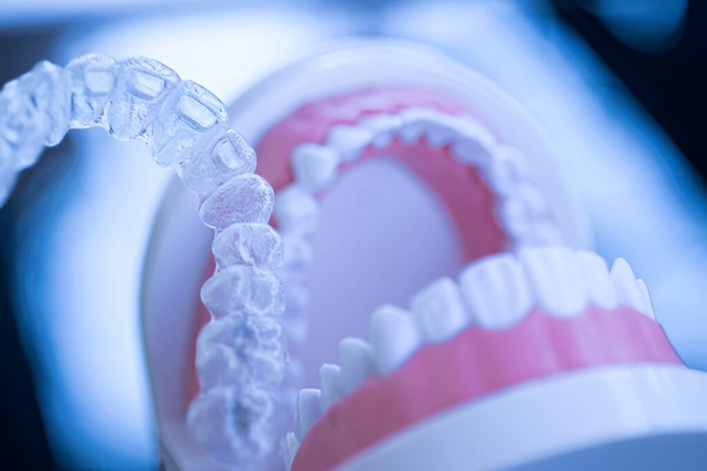 smile makeover boca raton