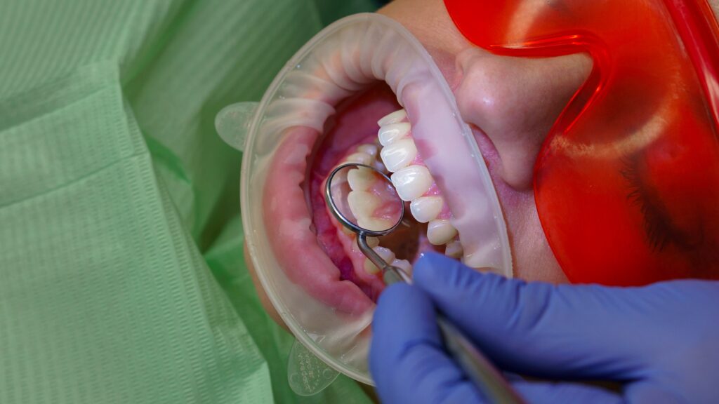 Gum Disease Treatment
