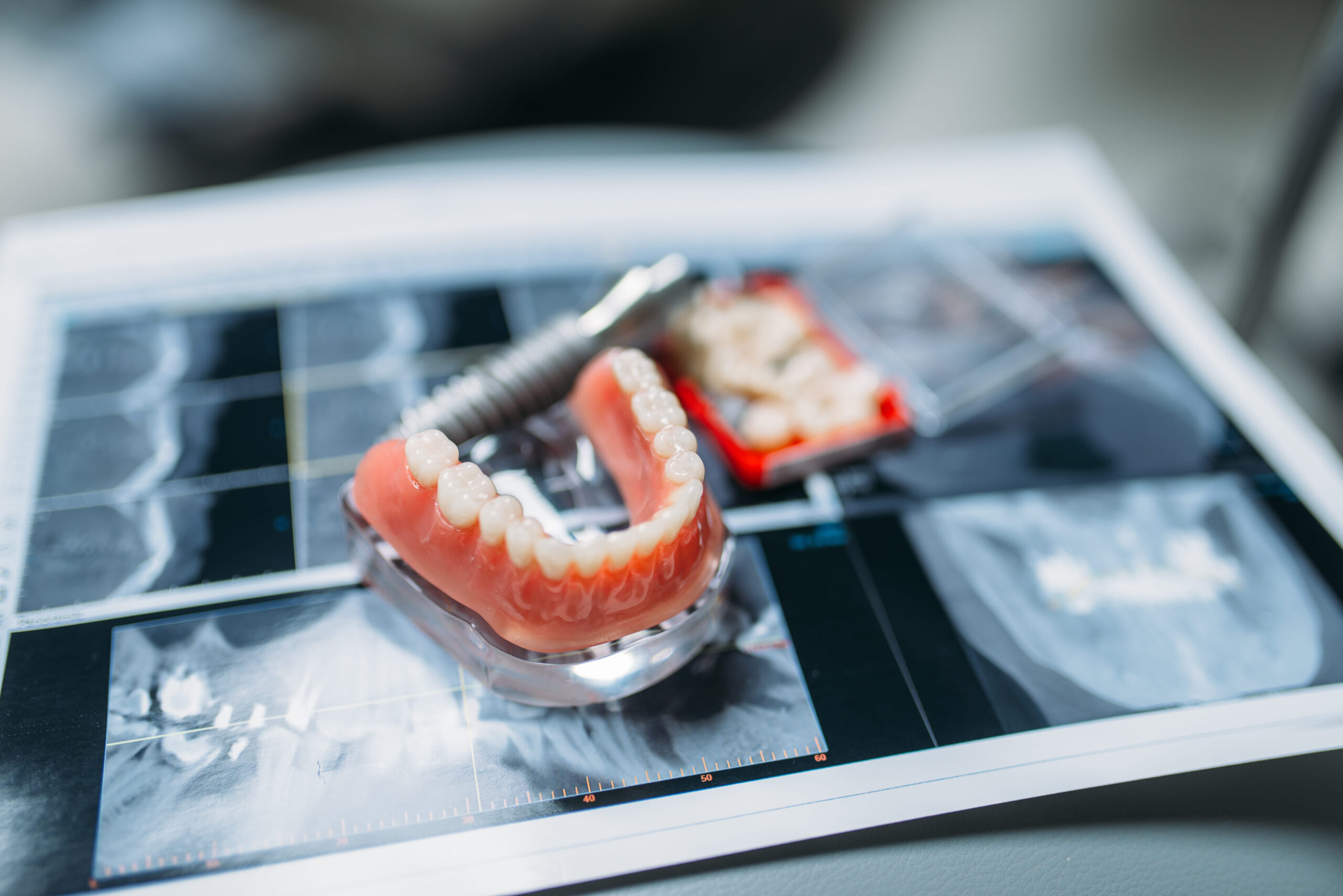 Digital Dentistry